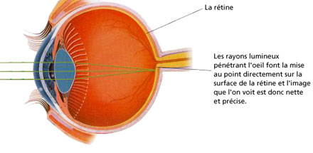 Oeil normal