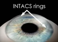 Intacts Rings